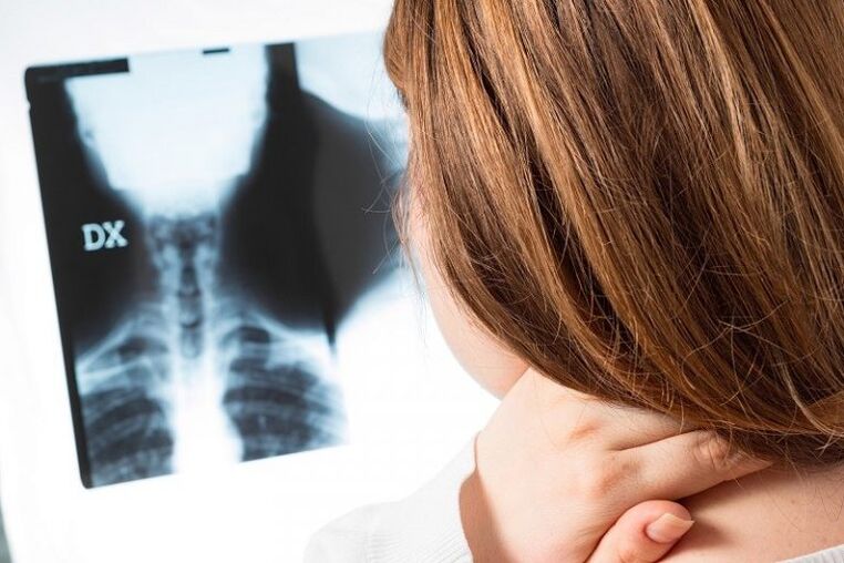X -ray của vùng cổ tử cung
