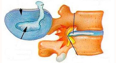 Các đặc điểm của sự phát triển của xương cổ tử cung